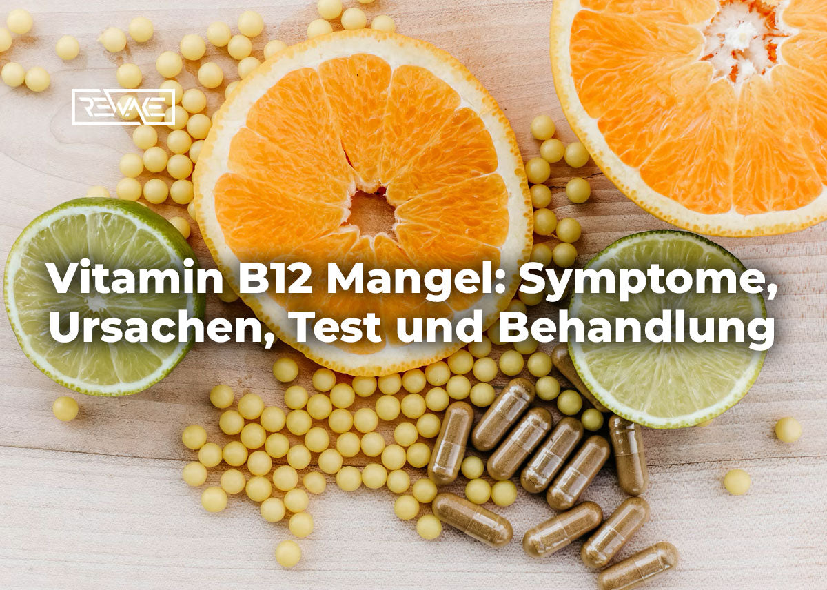 Lachs, Eier, Käse und ein Glas Milch auf einem hellen Tisch als natürliche Quellen bei Vitamin B12 Mangel